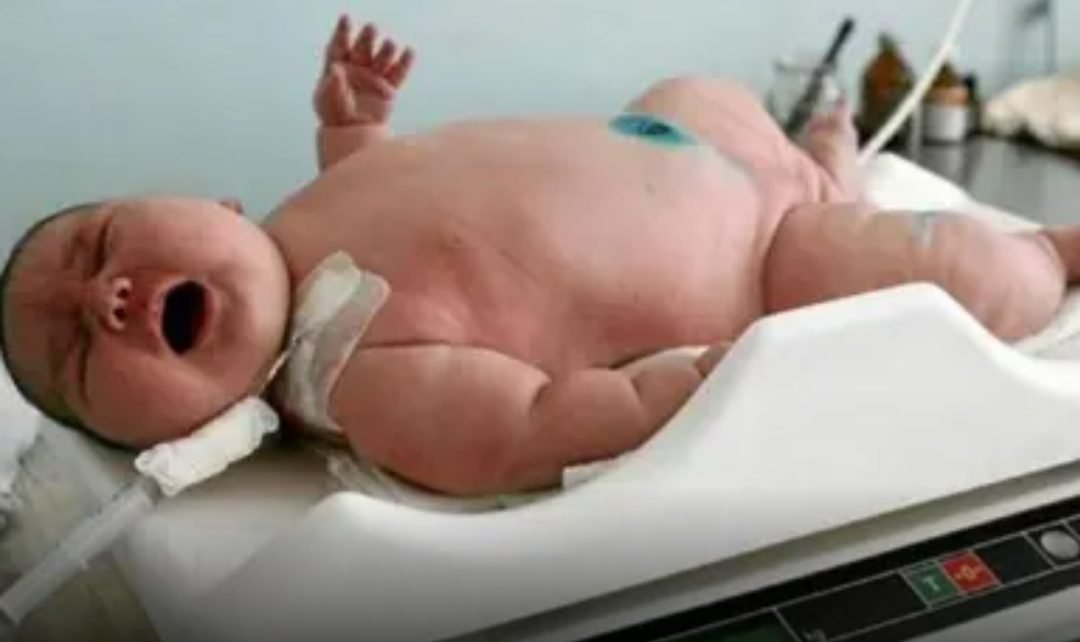 Nuevo Record Nacio El Bebe Mas Grande Del Mundo En Australia Pesa 18 Kg Infotdf